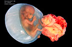 Grossesse de 11 SA - éléments anatomiques du sac gestationnel et du foetus - Iamges cliniques