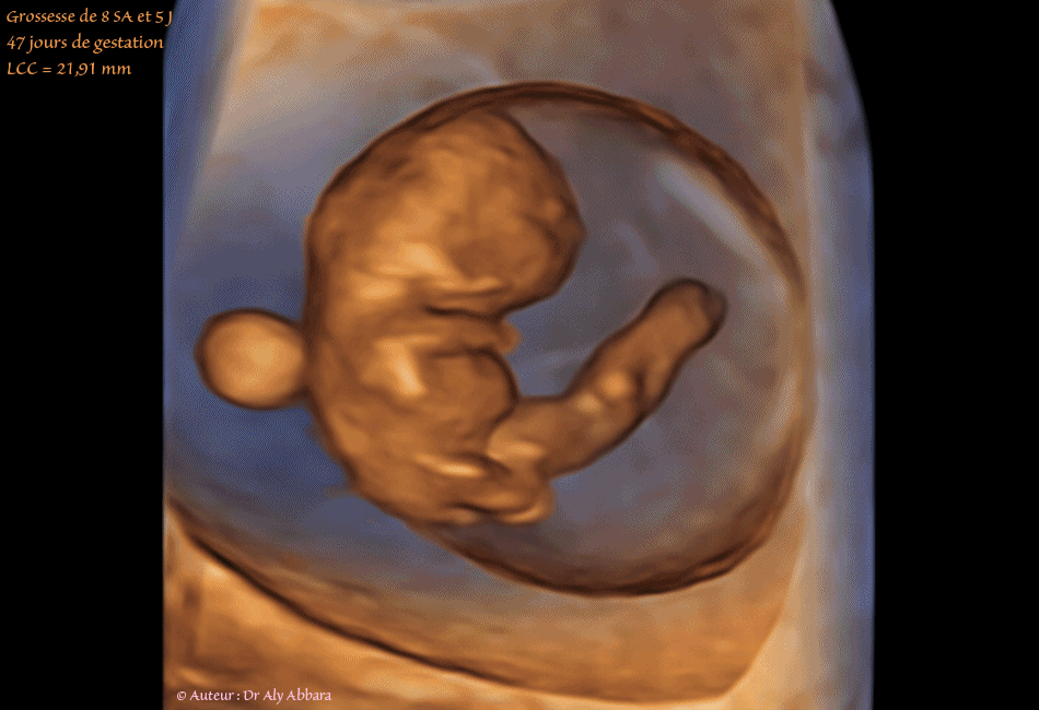 Embryon âgé de 47 jours de gestation (8 SA + 5 jours) - Composantes anatomiques - مضغة بعمر 47 يوماً - العناصر التشريحية الجنينية