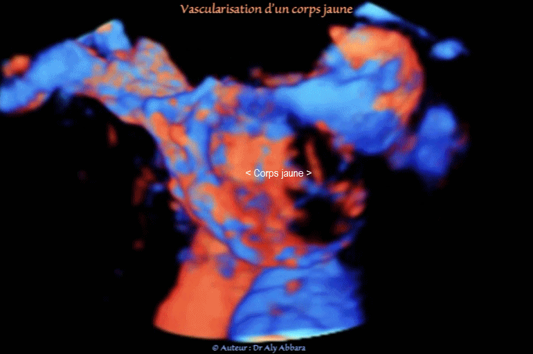 Vidéo et image échographiques en 3D montrant les caractéristiques de la vascularisation (analysée en mode Doppler Dynamic-Flow) d'un corps jaune dans l'ovaire droit : 