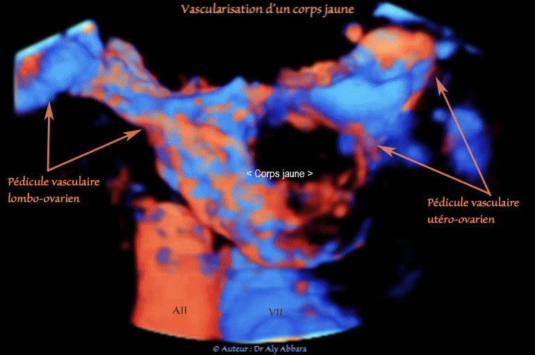 Vascularisation du corps jaune analysée en échographie 3D et Doppler mode Dynamic-Flow - الجسم الأصفر وتوعيته الخاصة 