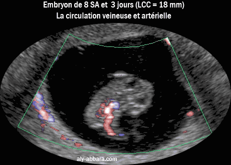 Analyse de la circulation embryonnaire veineuse et artérielle à 8,5 SA