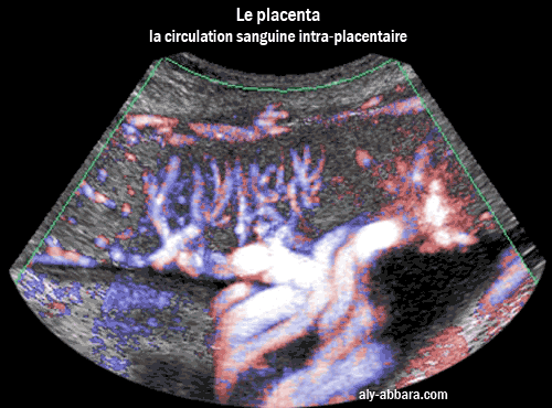 Image analysant la circulation placentaire et ses rapports à la circulation maternelle