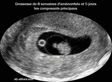 Analyse des annexes embryonnaire à 8 SA et 5 Jours