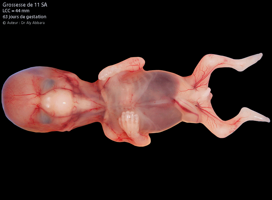 Grossesse de 11 SA - éléments anatomiques - images macroscopiques animéee