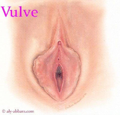 Vulve - Mutiliations sexuelles féminines - différents type de mutilation - Illustrations
