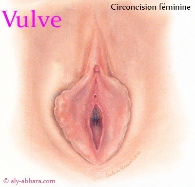 Circoncision féminine