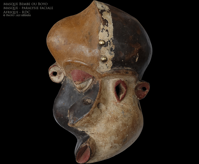 Art africain - Masque nosomorphe représentant une paralysie du nerf facial gauche - Bembe - RDC
