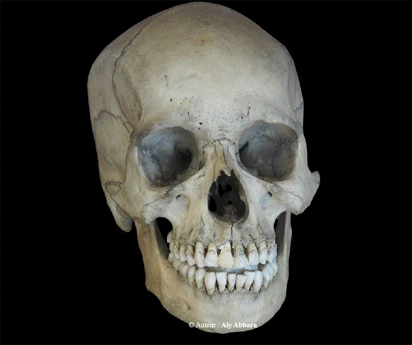 Crâne humain vrai - os craniens