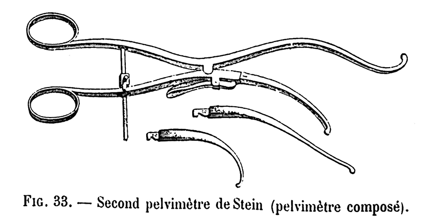 Second pelvimètre de Stein (pelvimètre composé)